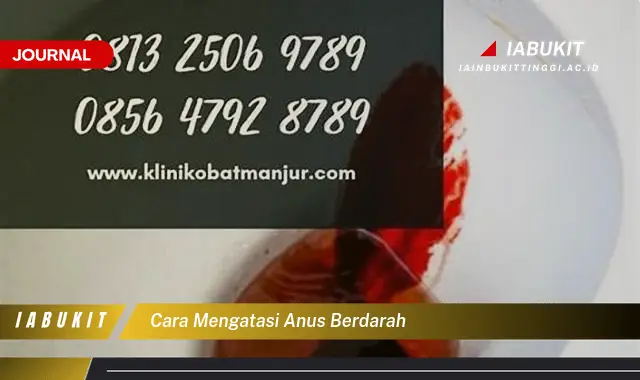 Ketahui Cara Atasi Anus Berdarah yang Jarang Diketahui Ketahui Cara Atasi Anus Berdarah yang Jarang Diketahui