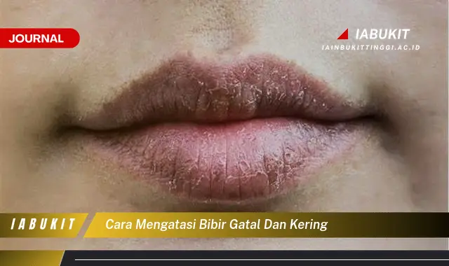 Ketahui Cara Atasi Bibir Kering & Gatal yang Mudah Dipahami