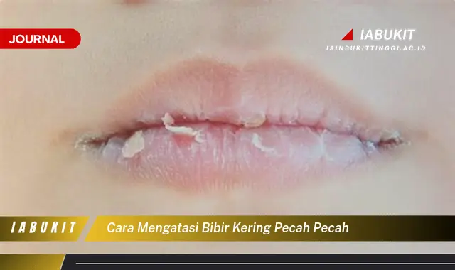 Ketahui Cara Atasi Bibir Kering Pecah,Pecah yang Mudah Dipahami