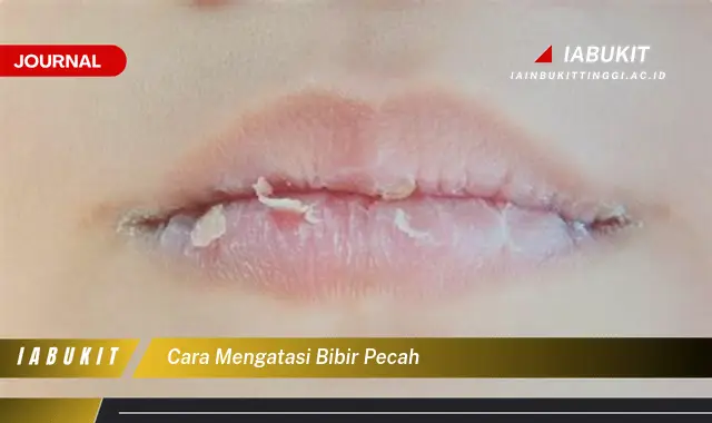 Ketahui Cara Mengatasi Bibir Pecah yang Jarang Diketahui