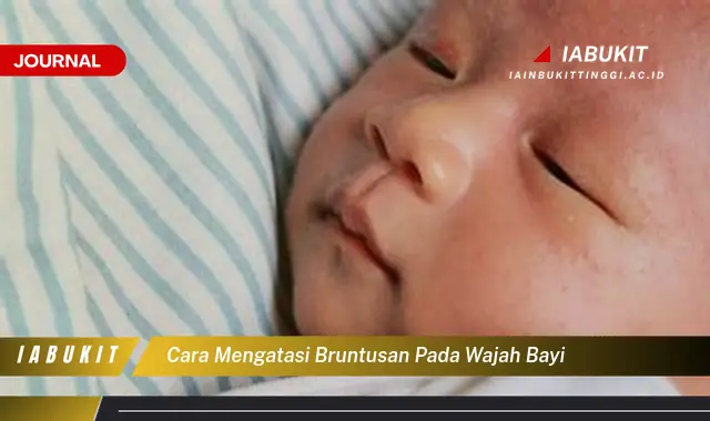 Ketahui Cara Atasi Bruntusan Bayi yang Mudah Dipahami