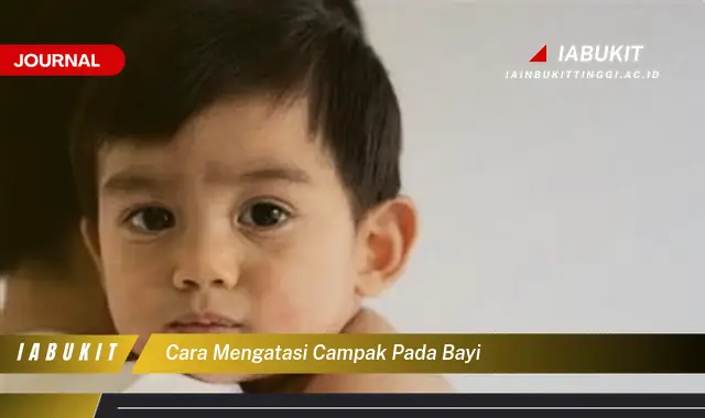 Ketahui Cara Mengatasi Campak pada Bayi yang Efektif