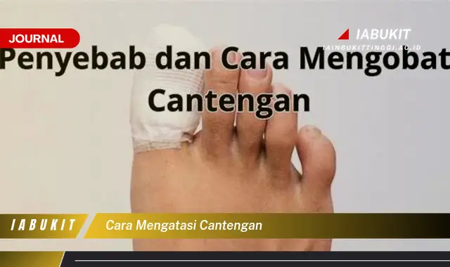 Ketahui Cara Mengatasi Cantengan yang Jarang Diketahui