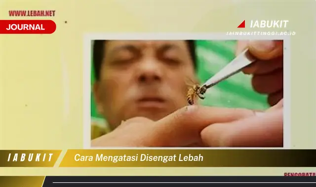 Ketahui Cara Mengatasi Sengatan Lebah Yang Jarang Diketahui