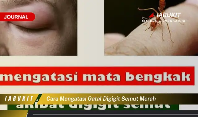 Ketahui Cara Mengatasi Gatal Digigit Semut Merah yang Mudah Dipahami