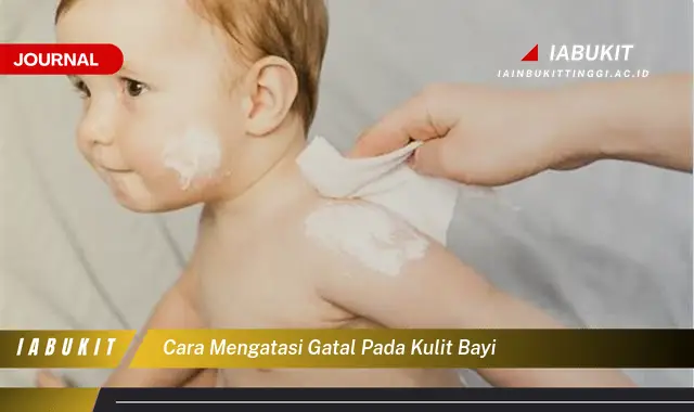 Ketahui Cara Mengatasi Gatal pada Kulit Bayi yang Aman