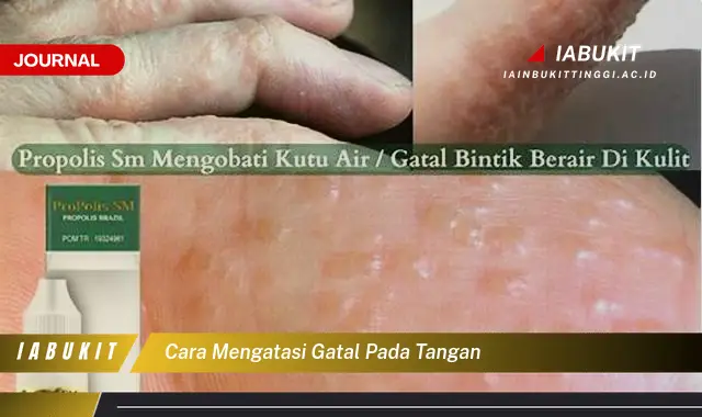 Ketahui Cara Atasi Gatal di Tangan yang Jarang Diketahui