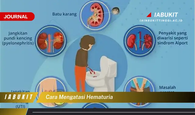 Ketahui Cara Mengatasi Hematuria yang Mudah Dipahami Ketahui Cara Mengatasi Hematuria yang Mudah Dipahami