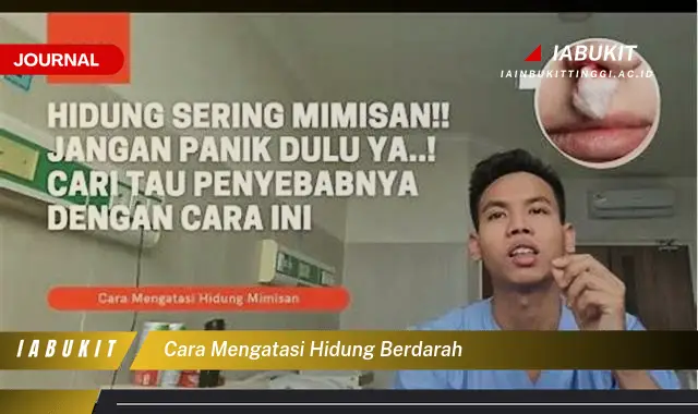 Inilah Cara Mengatasi Hidung Berdarah yang Mudah Dipahami