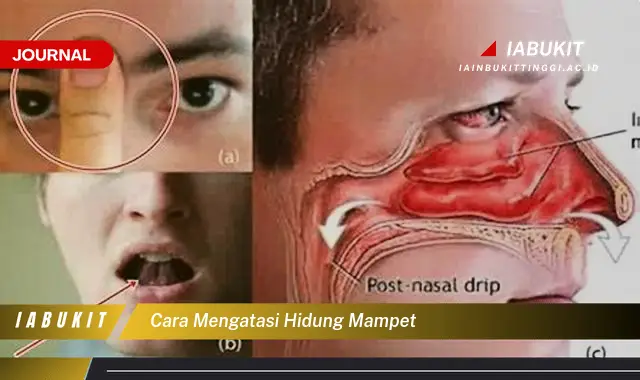 Ketahui Cara Atasi Hidung Tersumbat yang Mudah