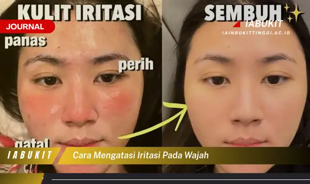 Ketahui Cara Atasi Iritasi Wajah yang Jarang Diketahui