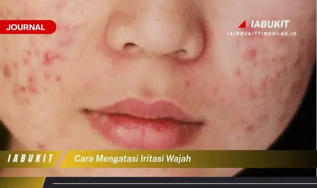 Ketahui Cara Mengatasi Iritasi Wajah yang Jarang Diketahui Ketahui Cara Mengatasi Iritasi Wajah yang Jarang Diketahui
