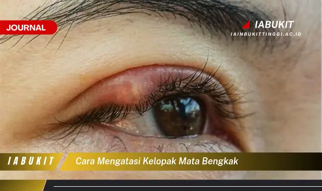 Ketahui Cara Mengatasi Kelopak Mata Bengkak yang Jarang Diketahui