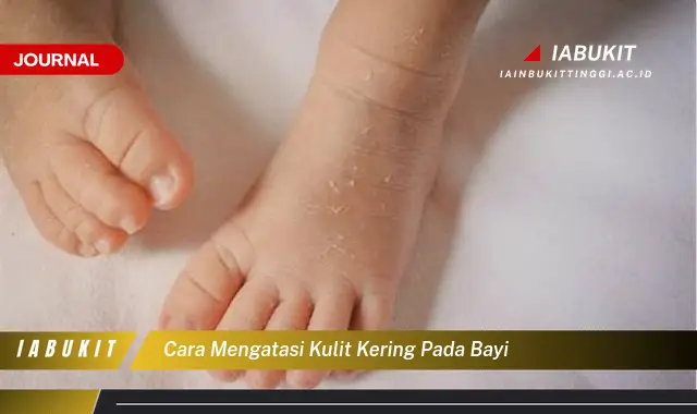 Ketahui Cara Atasi Kulit Kering Bayi yang Jarang Diketahui