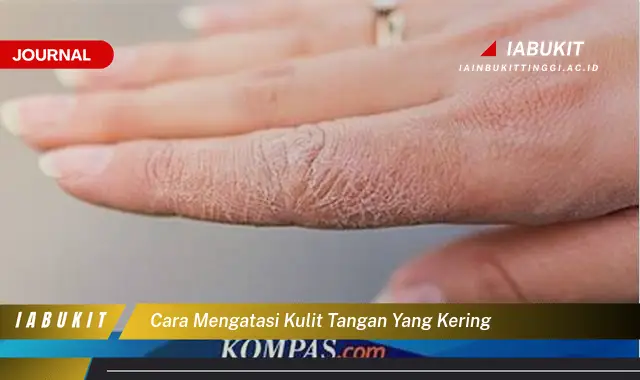 Ketahui Cara Mengatasi Kulit Tangan Kering yang Jarang Diketahui