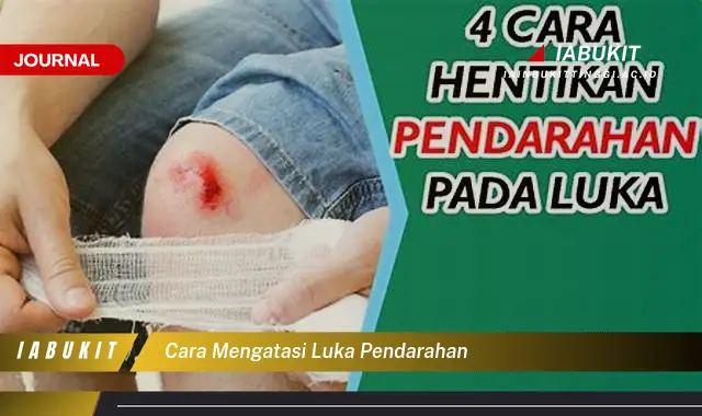 Ketahui Cara Mengatasi Luka Pendarahan yang Mudah Dipahami