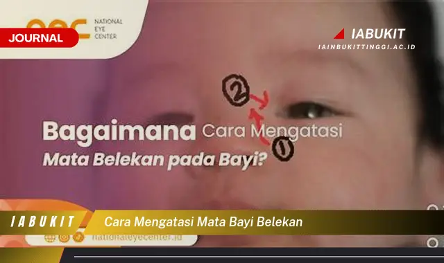 Ketahui Cara Mengatasi Mata Bayi Belekan yang Aman