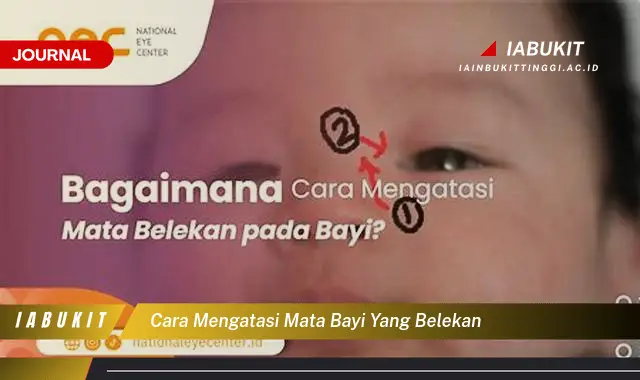 Ketahui Cara Atasi Mata Belekan Bayi yang Mudah Dipahami