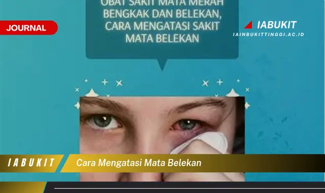 Temukan Cara Atasi Mata Belekan yang Mudah Dipahami