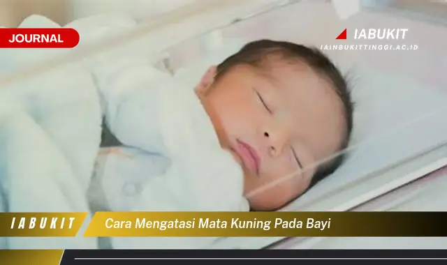 Ketahui Cara Atasi Mata Kuning Bayi yang Mudah Dipahami