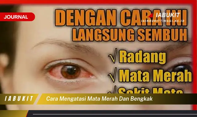 Ketahui Cara Atasi Mata Merah Bengkak yang Jarang Diketahui