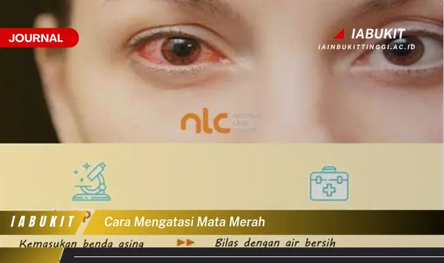 Inilah Cara Mengatasi Mata Merah yang Mudah Dipahami