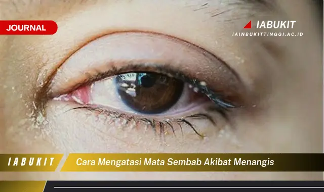 Ketahui Cara Atasi Mata Sembab Setelah Menangis yang Mudah Dipahami