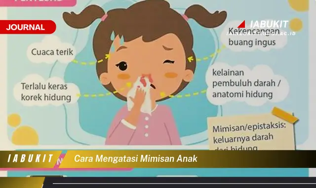 Ketahui Cara Mengatasi Mimisan Anak yang Mudah Dipahami