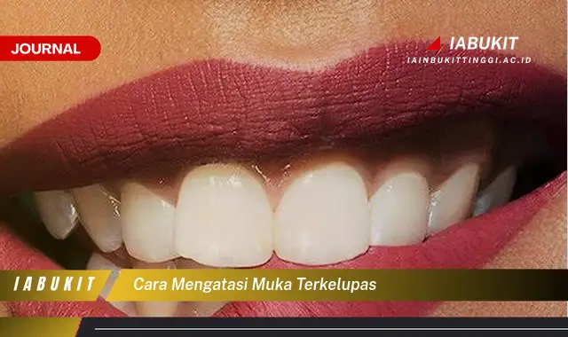 Ketahui Cara Mengatasi Muka Terkelupas yang Mudah Dipahami