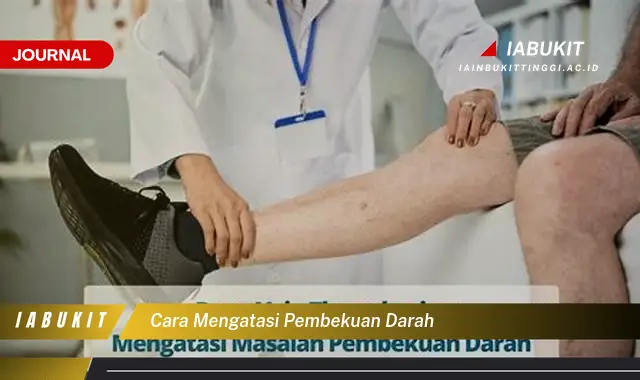 Ketahui Cara Atasi Pembekuan Darah yang Jarang Diketahui