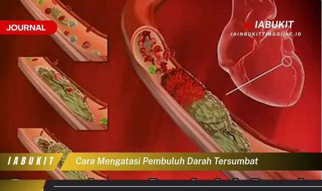 Ketahui Cara Atasi Pembuluh Darah Tersumbat yang Jarang Diketahui