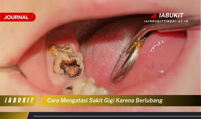 Ketahui Cara Atasi Sakit Gigi Berlubang yang Jarang Diketahui