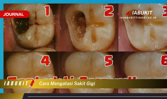 Ketahui Cara Mengatasi Sakit Gigi yang Jarang Diketahui