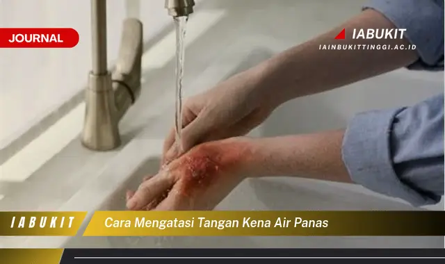 Ketahui Cara Mengatasi Tangan Kena Air Panas yang Mudah Dipahami