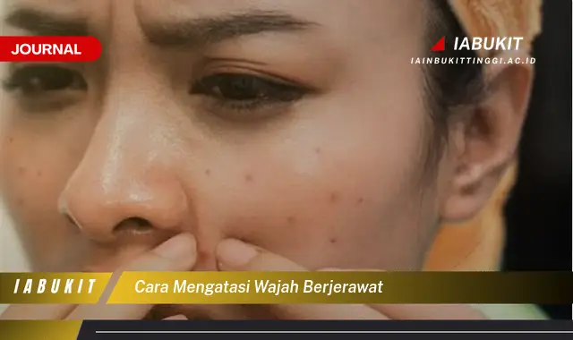 Temukan Cara Mengatasi Jerawat yang Jarang Diketahui