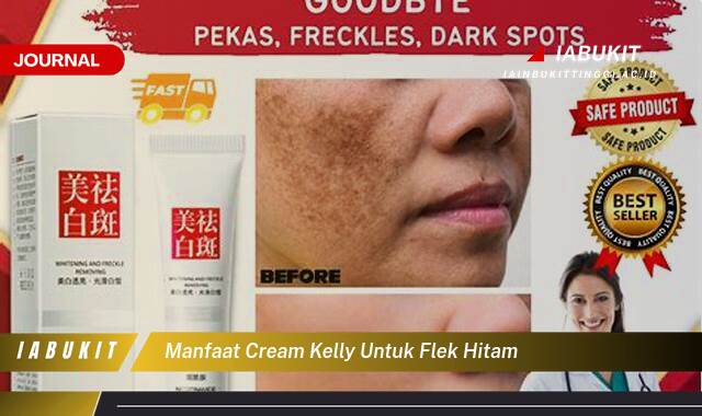 Inilah 10 Manfaat Cream Kelly untuk Menghilangkan Flek Hitam di Wajah Secara Ampuh