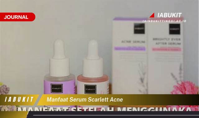 Inilah 9 Manfaat Serum Scarlett Acne untuk Mengatasi Jerawat dan Bekasnya