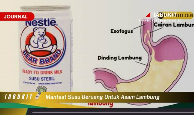 Inilah 10 Manfaat Susu Beruang untuk Asam Lambung, Meredakan Gejala dan Tips Konsumsi yang Benar